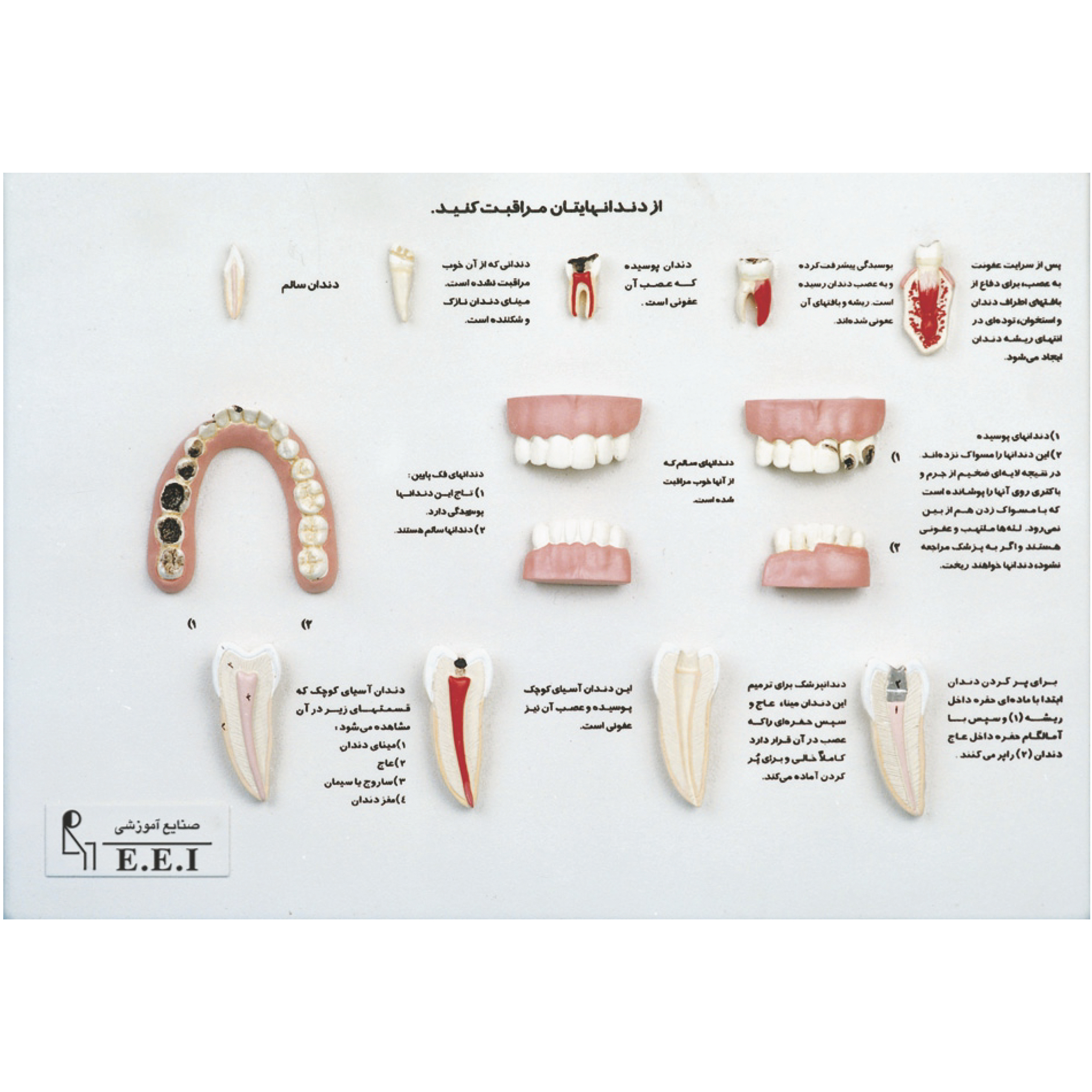 مدل مراقب دندان های خودباشید - مراقبت از دندان‌ها باعث می‌شود زندگی سالم، طولانی و بدون درد را تجربه کنیم. داشتن دندان‌های سالم بر زیبایی فرد بسیار حائز اهمیت است. در این مدل سعی شده با نمایش دندان‌های پوسیده و سالم در کنار یکدیگر اهمیت مراقبت از دندان‌ها نشان داده شود. برخی از دندان‌ها در اندازه طبیعی و برخی دیگر بزرگتر از انداز ...