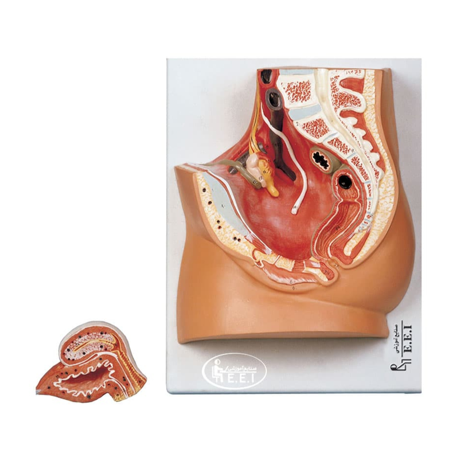 مدل لگن خاصره زن - این مدل در اندازه طبیعی است و به دو قطعه تفکیک می‌شود. در این مدل ساختمان مثانه و اندام‌های تناسلی زن در مقطع میانی و موقعیت آن‌ها در حفره لگن نمایش داده شده است. مدل روی تخته نصب شده است. مدل‌های آناتومی تولید شرکت صنایع آموزشی دارای نشان استاندارد ملی به شماره 11316 می‌باشند.pvc به‌کاررفته فاقد آز ...