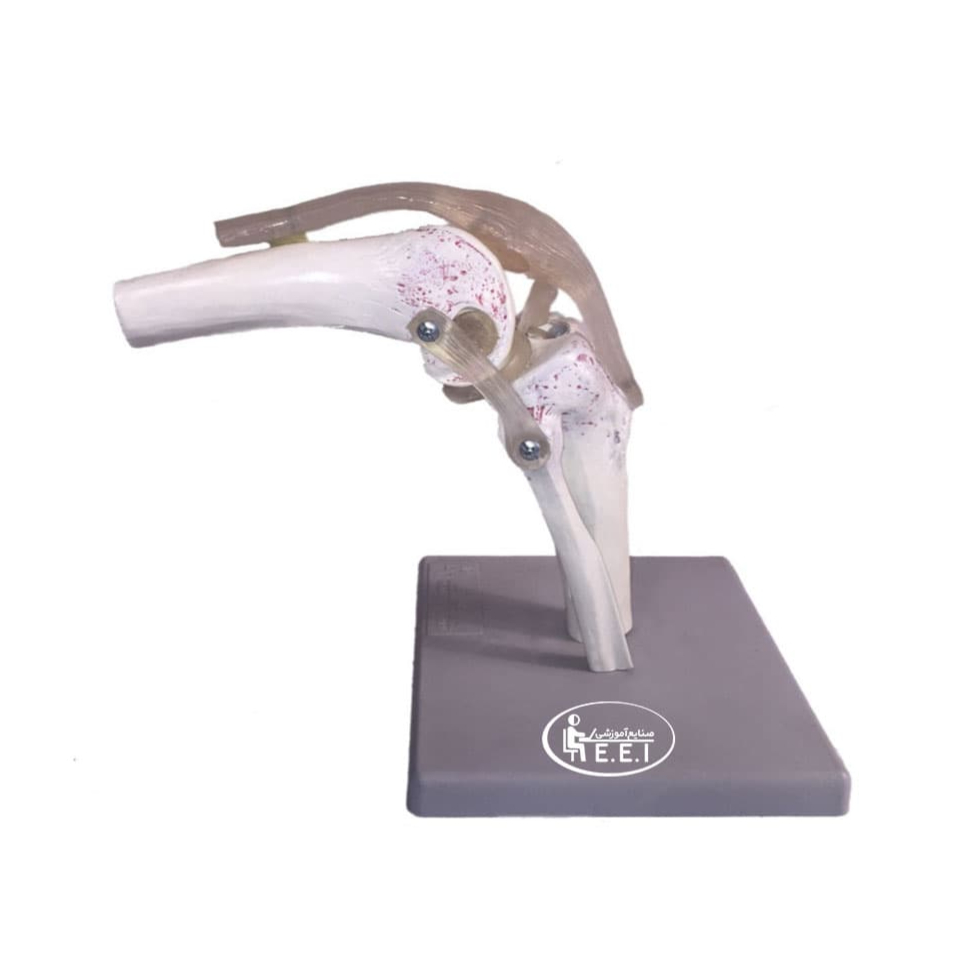 مدل مفصل زانو - زانو بزرگ‌ترین مفصل بدن انسان است و ران را به ساق پا پیوند می‌دهد. طرح ساختمانی زانو تا حدی ناپایدار است. با این وجود زانو باید کل وزن بدن را هنگام ایستادن تحمل کند، و هنگام راه‌رفتن یا دویدن حتی وزن بیشتری به آن تحمیل می‌شود. این مدل در اندازه طبیعی است و از یک قطعه تشکیل شده است. بخش انتهایی استخو ...