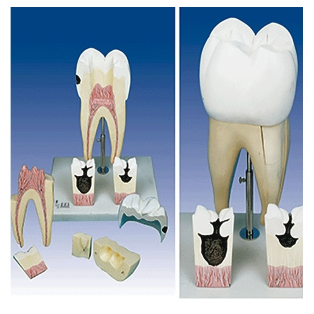 مدل اولین دندان آسیاب فک تحتانی - این مدل تقریبا 16 برابر اندازه طبیعی در 8 قطعه با برش طولی در ناحیه تاج و ریشه می‌گذرد به دو قطعه تقسیم می‌شود. در ناحیه تاج، نیمی از مینا و عاج و در ناحیه ریشه بخشی از عاج تفکیک می‌شود. بزرگی مدل، آموزش ساختمان دندان را به خوبی میسر می‌سازد. در این مدل همچنین ریشه‌ها، کانال‌های مربوطه و قطعه‌‌هایی  ...